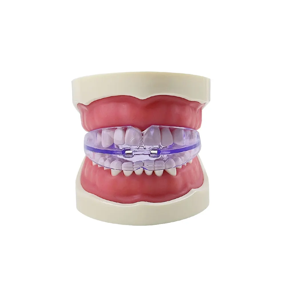 Dental Tooth Orthodontic Appliance Trainer Alignment Teeth Straightener Braces For Adults Orthodontic Teeth Corrector Hard Soft