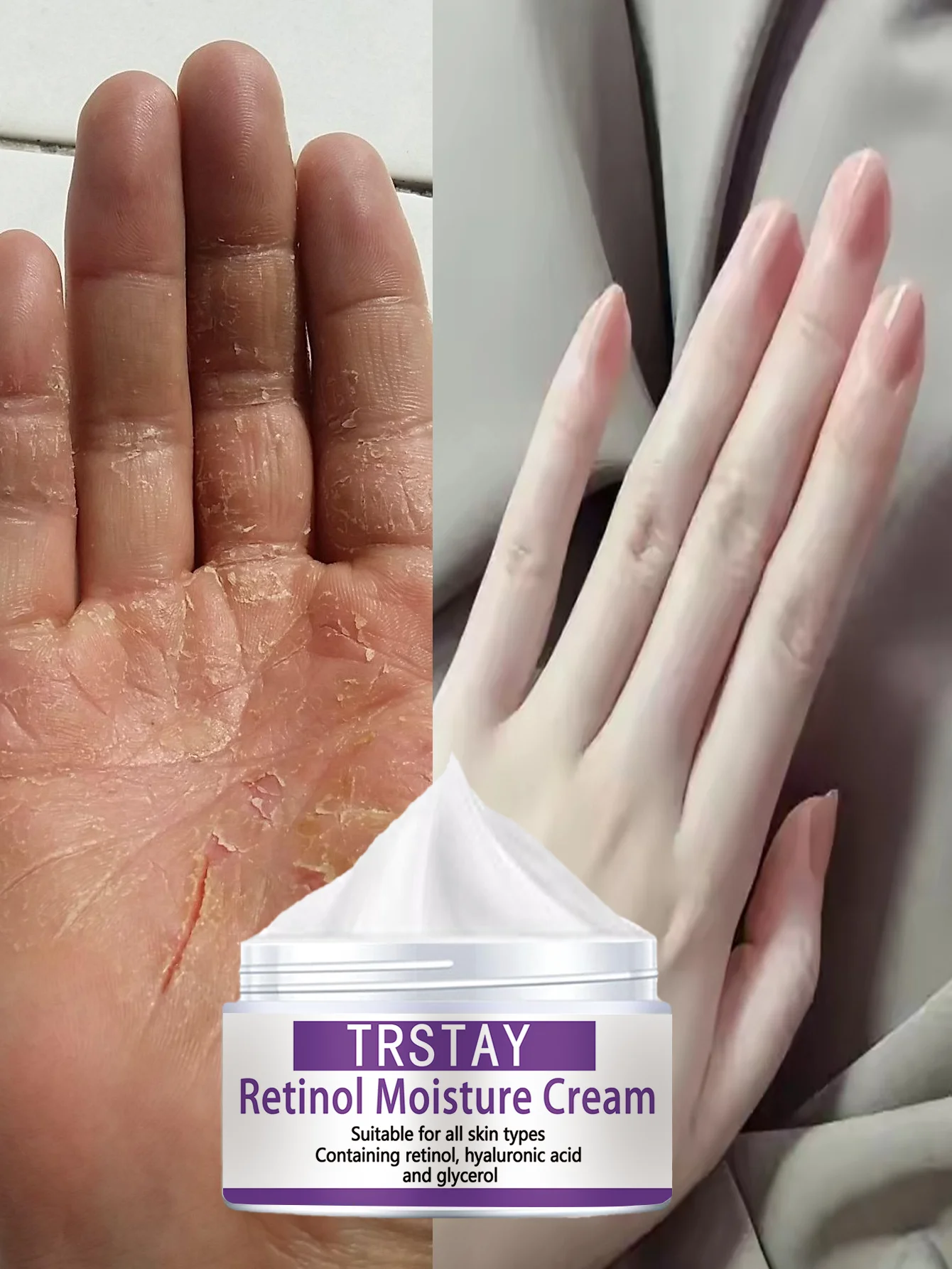 

Long Lasting Moisturizing Vitamin E Hand Oil for Whitening and Softening Skin with Deep Hydration and Nourishing Benefits for Al