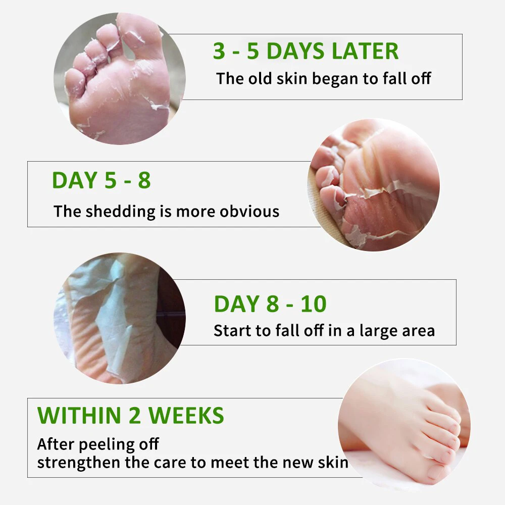 Flowweek Exfoliërend Voetmasker-Huid Exfoliërend Voetmasker Voor Droge, Gekapte Voeten, Eelt, Dode Huidverwijderaar, Exfoliant