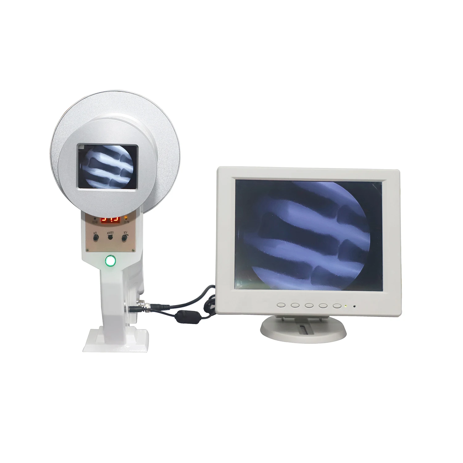 Portable Digital fForoscope x Ray Machine on Sale, X-ray Machine Fluoroscopy Made in China