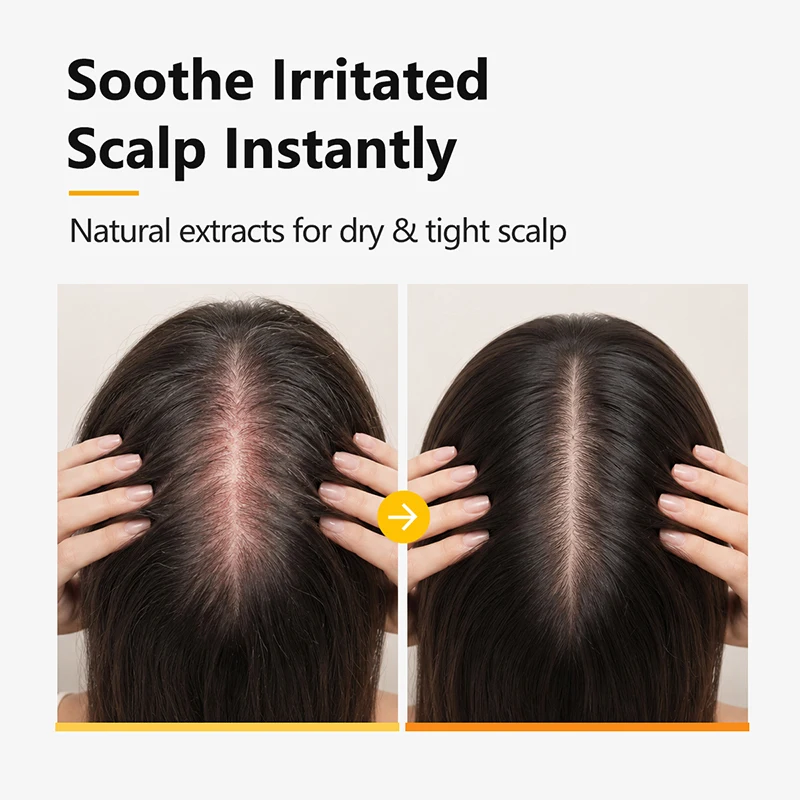 PURC Biotin Peptide Scalp Essence Oil Hair Growth Serum Leave-in Stronger Roots Fuller Thicker Nourishing Anti-Hair Loss Care