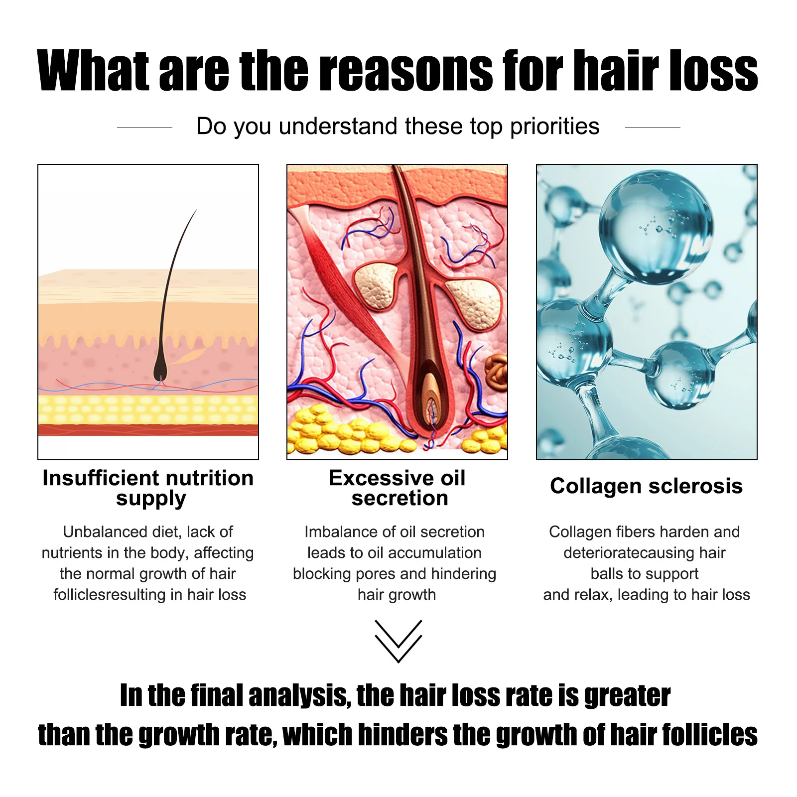 30 مللي جوهر شعر رجالي من East Moon مكمل قوي ومتين ومرطب مغذي يمنع السقوط حل العناية بالشعر الكثيف القابل للتصت