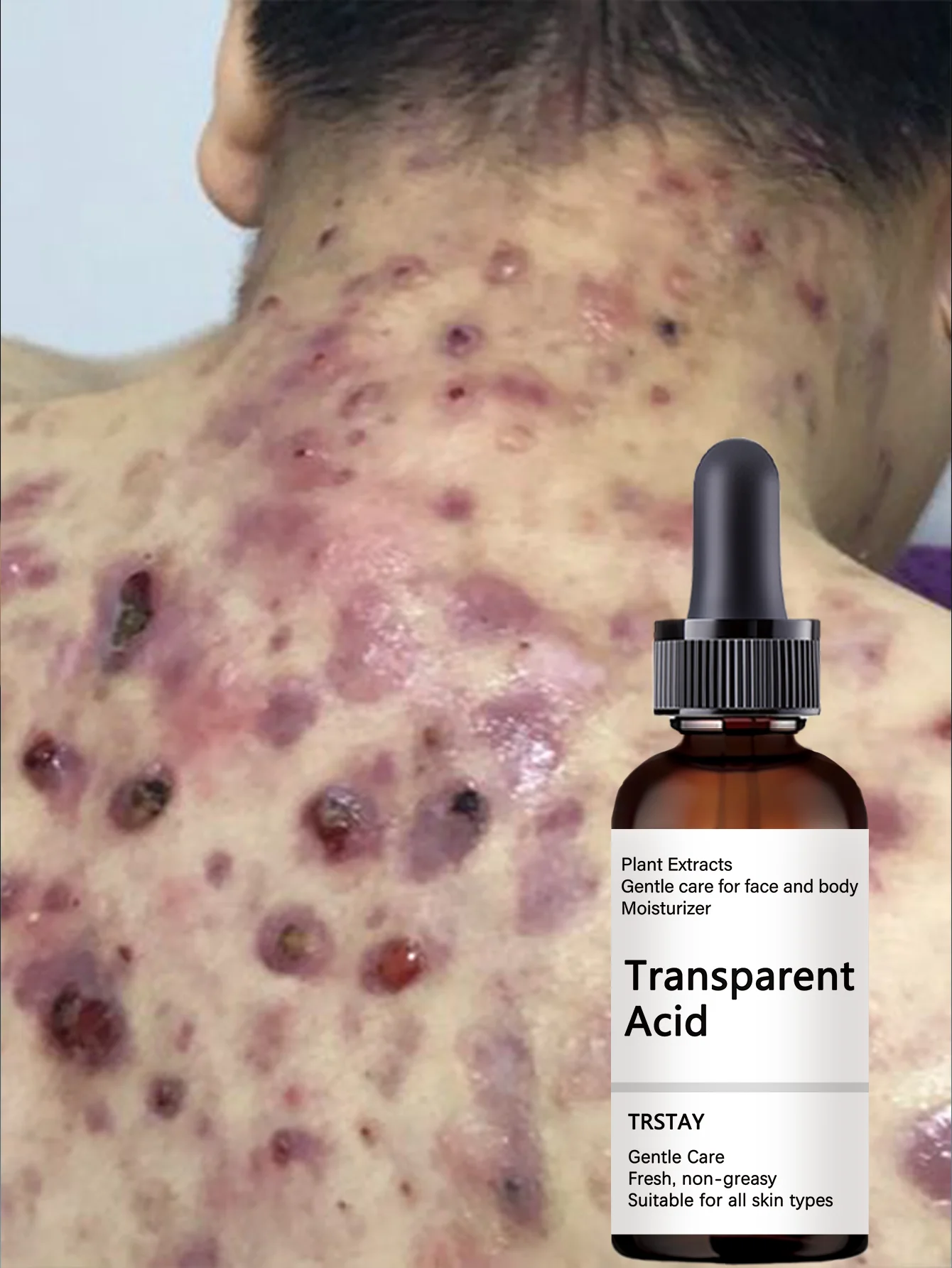 Moisturizing Essential Oil for Lifting and Repairing Delicate Skin with Firming Smoothing Effect to Radiate Youthful Radiance an - Image 5