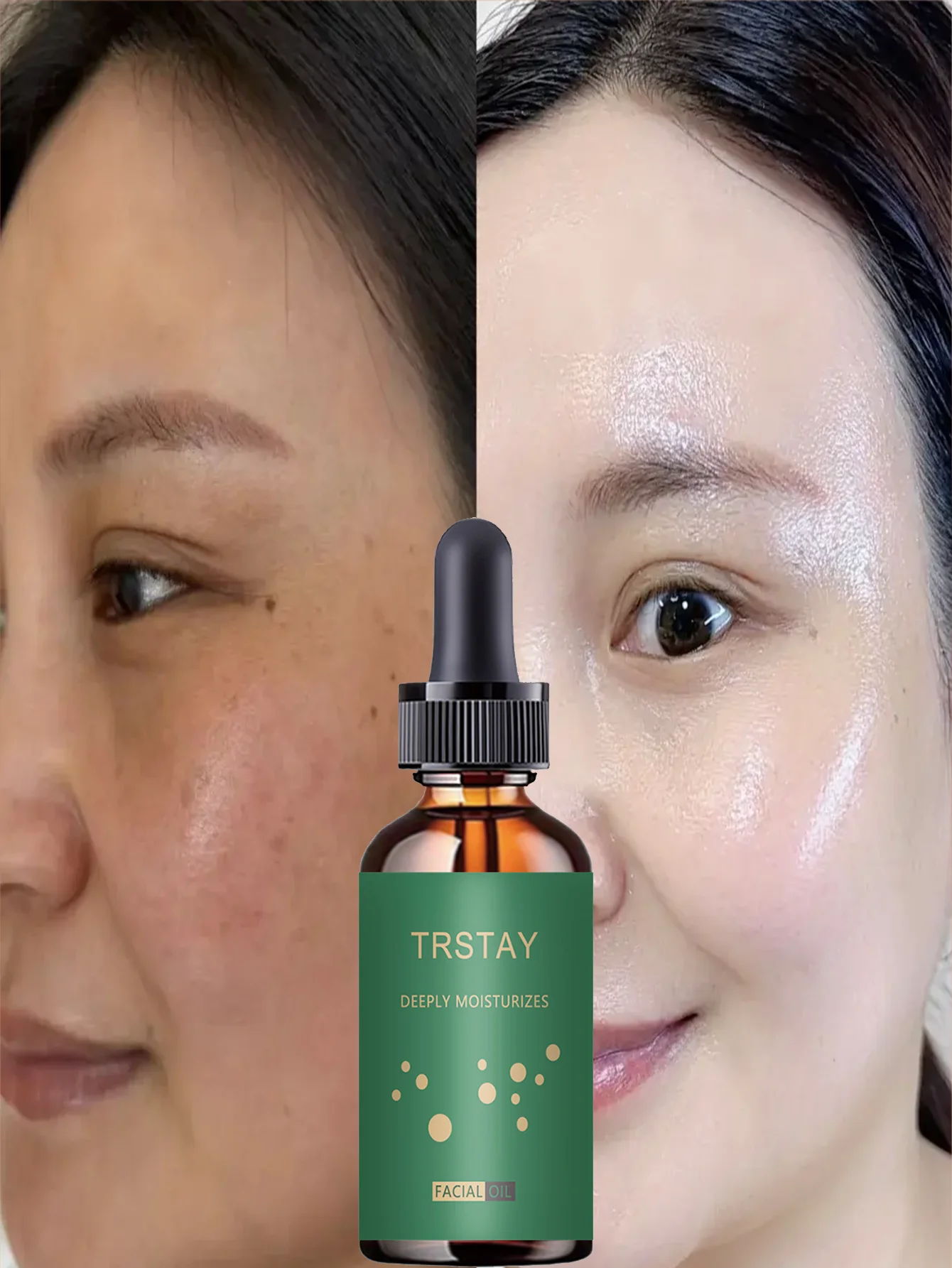 Facial Moisturizing Serum - Gentle and Non-Irritating, With Plant Extracts, Hydrating and Moisturizing, Suitable for All Skin Ty