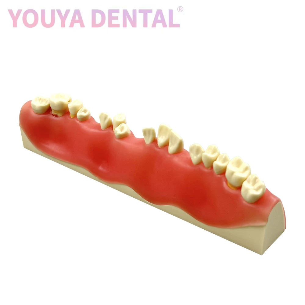 

1 шт., стоматологическая модель аппического абсссы, перипедийное поражение, перирадикулярный периодонт, абссмы, изысканная студенческая практическая тренировочная модель