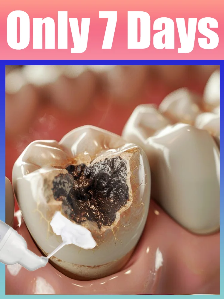 

Generation-2 Bubbles Says Goodbye To Intraoral stones In 7 Days