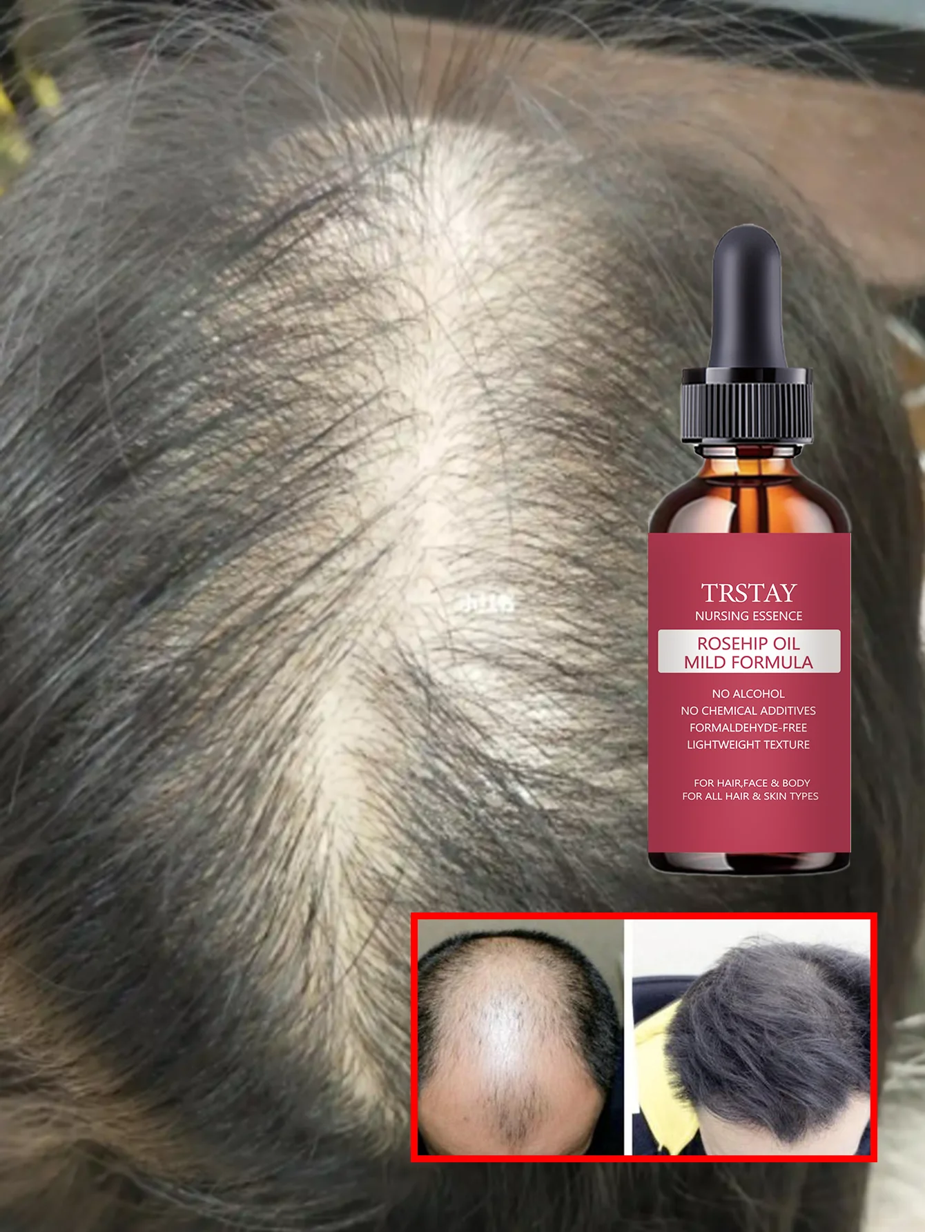 Moisturizing Hair Treatment To Reduce Frizz And Make Hair Fluffy While Protecting Strands And Enhancing Shine For Smooth Silky H - Image 3