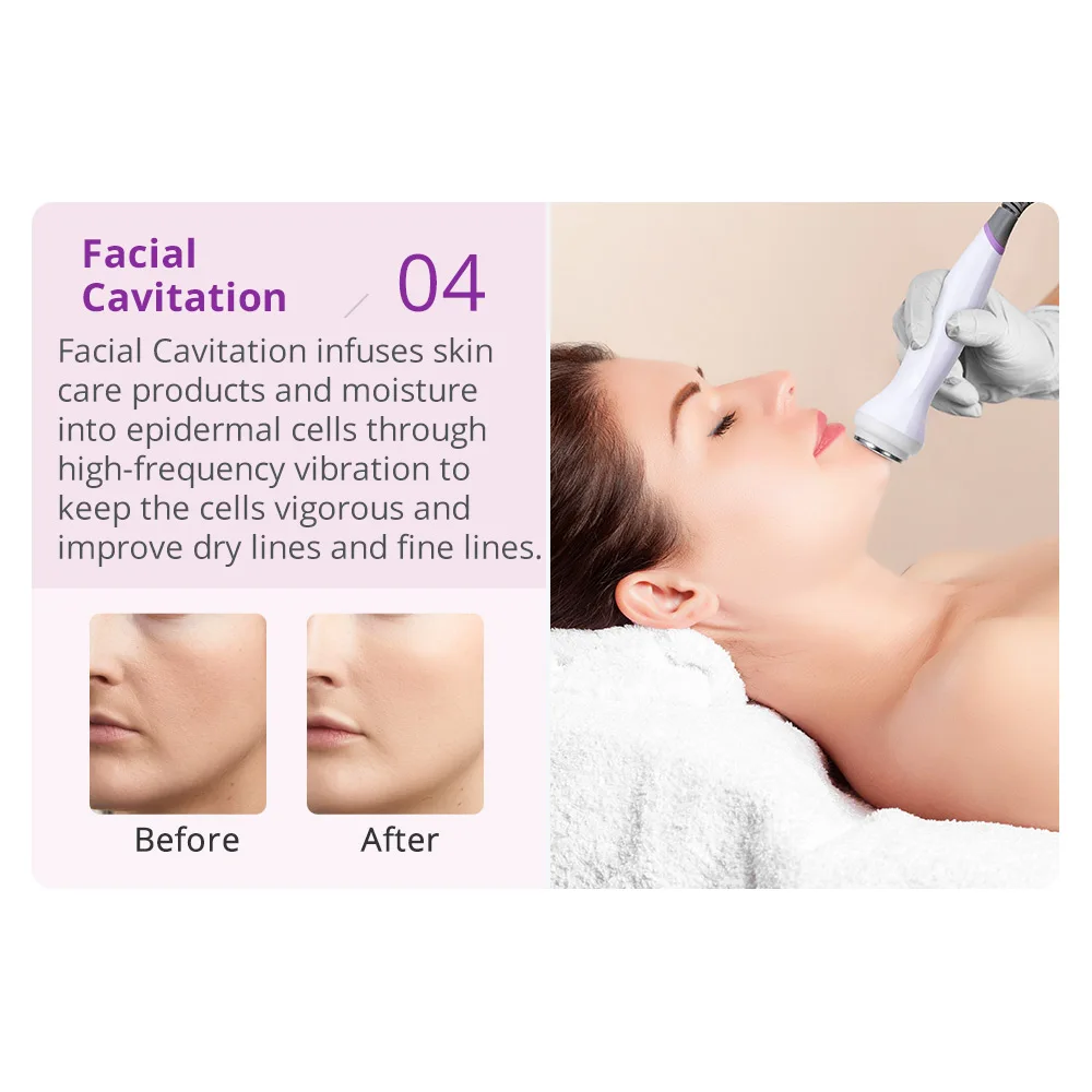 هيدرو اللوازم الطبية أكوا تقشير H2O2 آلة الوجه هيدرا المياه جلدي الجلد الغسيل قشر الأكسجين النفاثة جهاز للعناية بالوجه #5