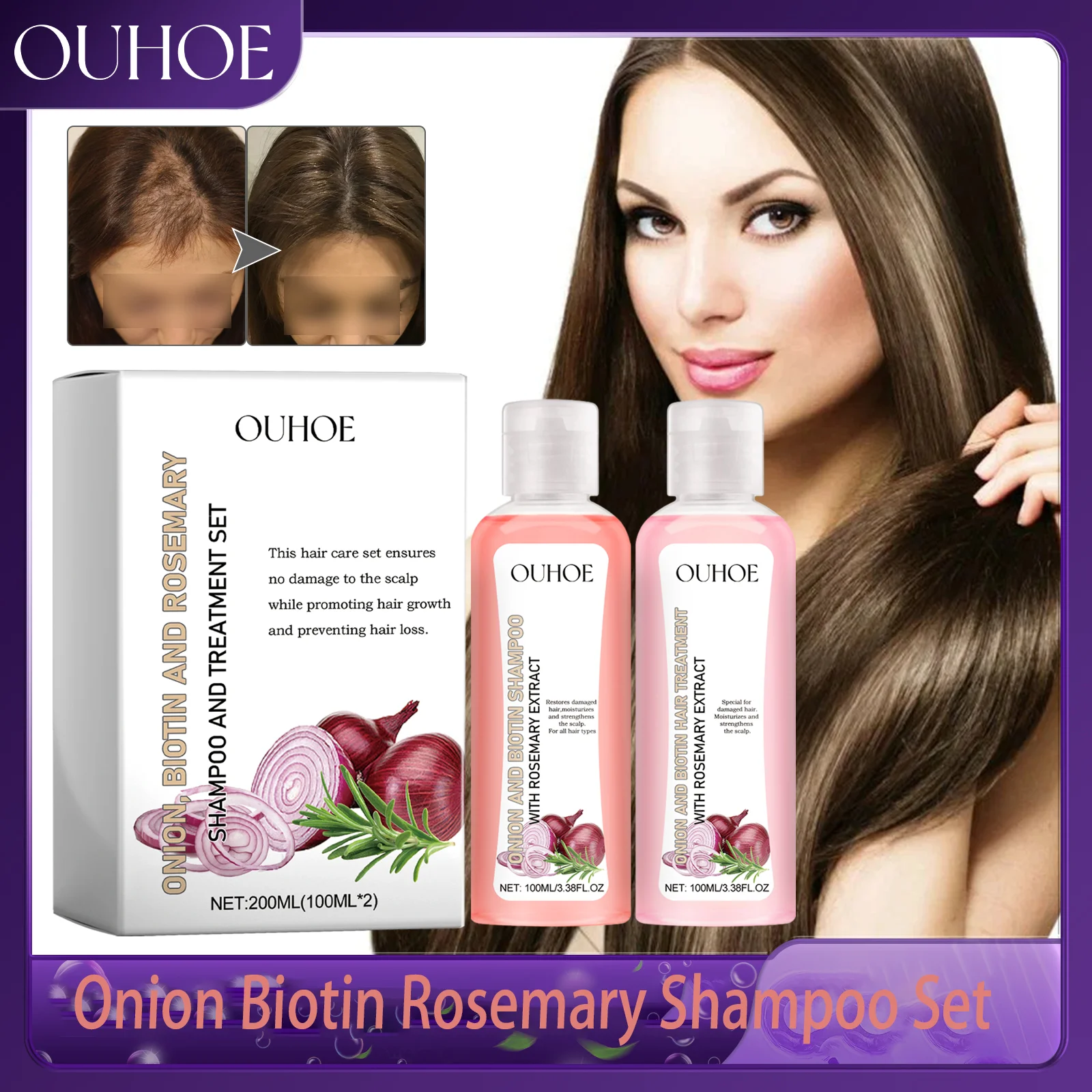 

Ouhoe Onion Biotin Rosemary Shampoo Set Nourishes Hair Roots Scalp Shiny Hair All Hair Types Hair Shampoo Hair Care Gift