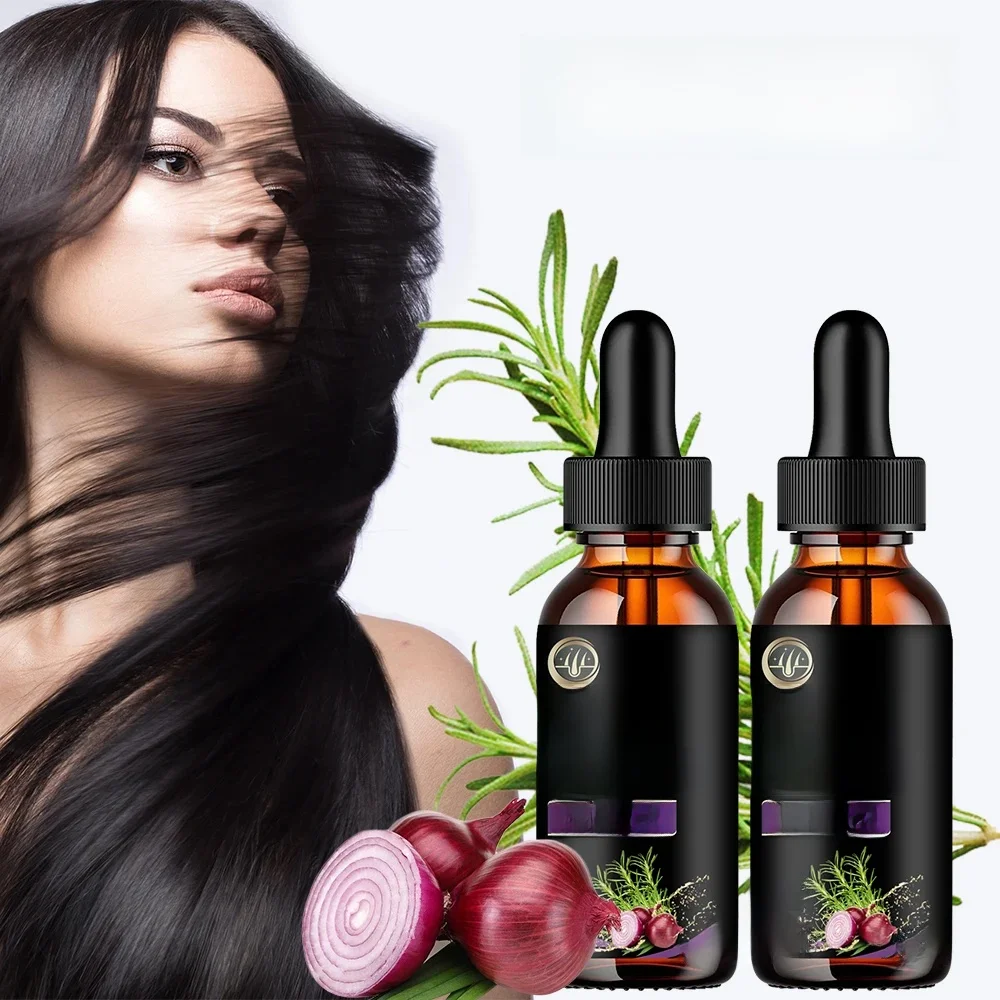 Huile essentielle de croissance rapide des cheveux, oignon, romarin, soin capillaire, régénération des cheveux, produit efficace contre la perte de cheveux