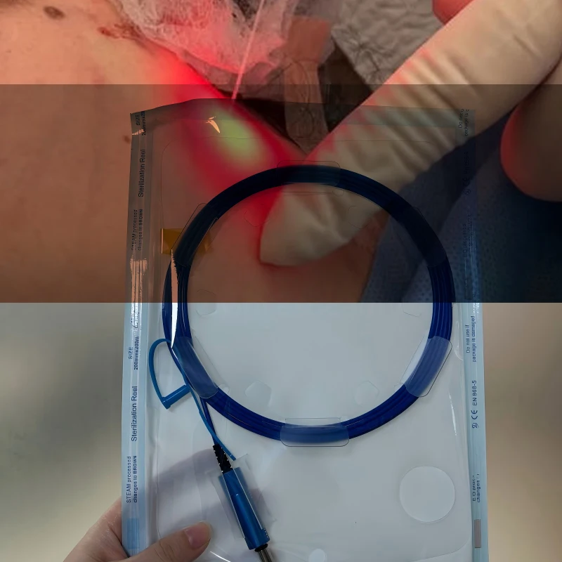 

3m Fiber Optic 600um 800um Lipid Catabolism Fiber Optic SMA905 Connector Spare Parts Consumables Fat Dissolving Weight Loss