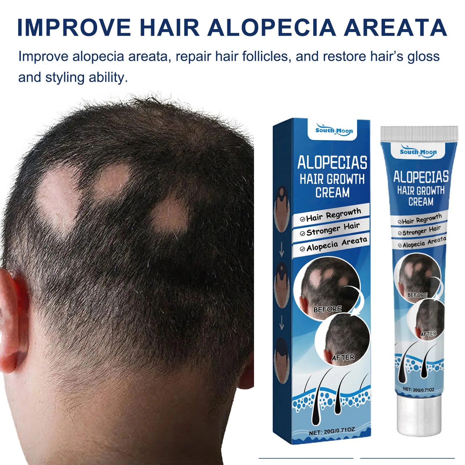 Alopecias Hair Growth Cream Nourish Scalp Improve Hair Loss Prevent Baldness Increase Hair Volume Thicken Hair Regrowth Product