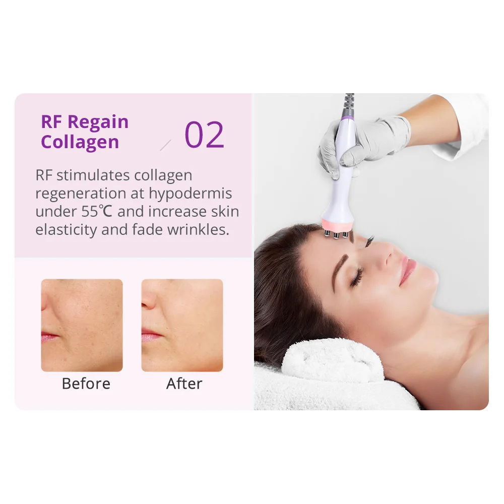 هيدرو اللوازم الطبية أكوا تقشير H2O2 آلة الوجه هيدرا المياه جلدي الجلد الغسيل قشر الأكسجين النفاثة جهاز للعناية بالوجه #1