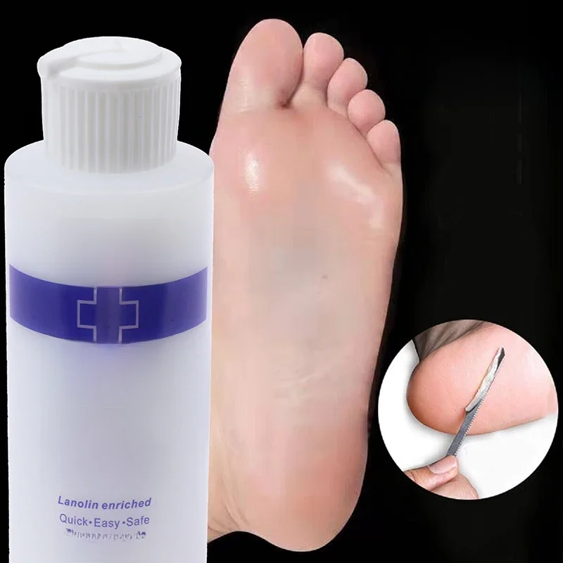 30/177ml pied cuticule enlever pied mort exfoliant adoucisseur enlever la peau morte et les callosités masque pour les pieds pédicure rehausseur d'ongles