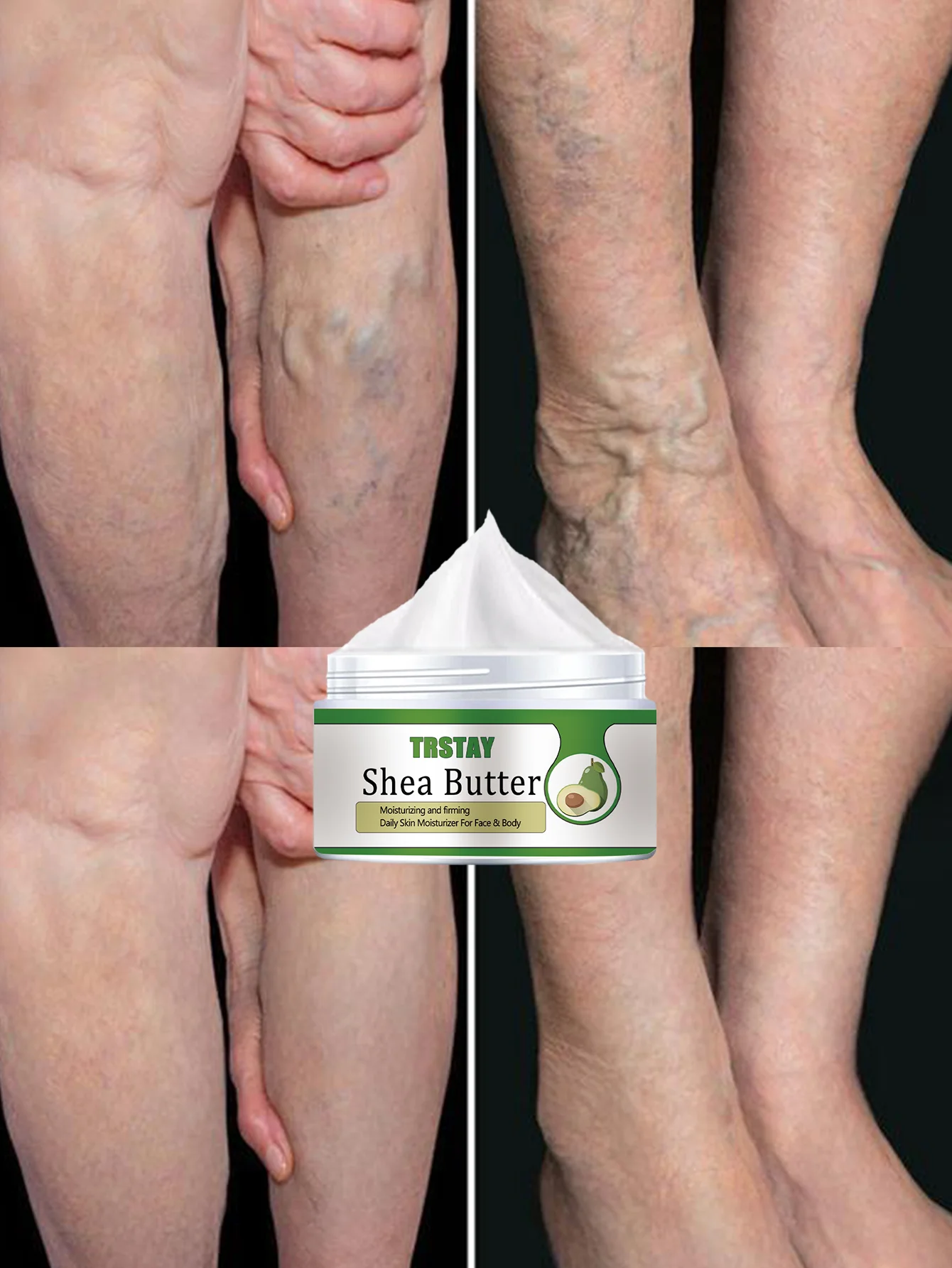 

Varicose Veins Relief Body Cream Deep Hydration Moisturizing Repairing Skin Relieving Swelling Tightness Essential for Prolonged