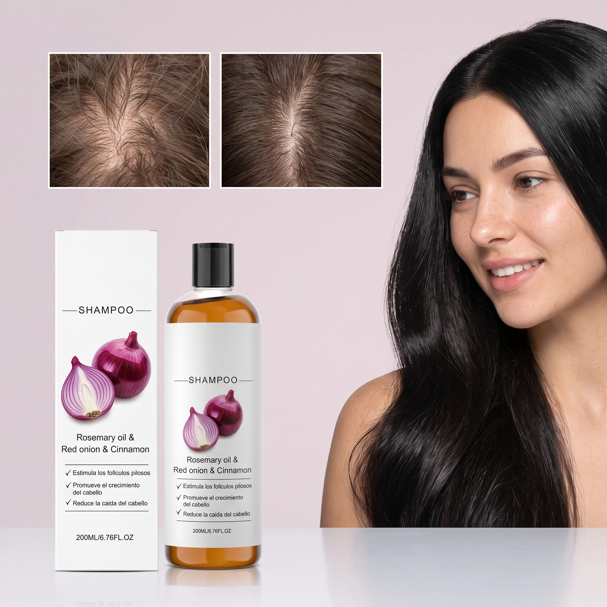 Champú para el cabello de cebolla roja de 200ML, limpieza suave del cuero cabelludo, hidratante, reparador del cabello dañado, nutritivo, refrescante, control de aceite, champú para dar volumen al cabello