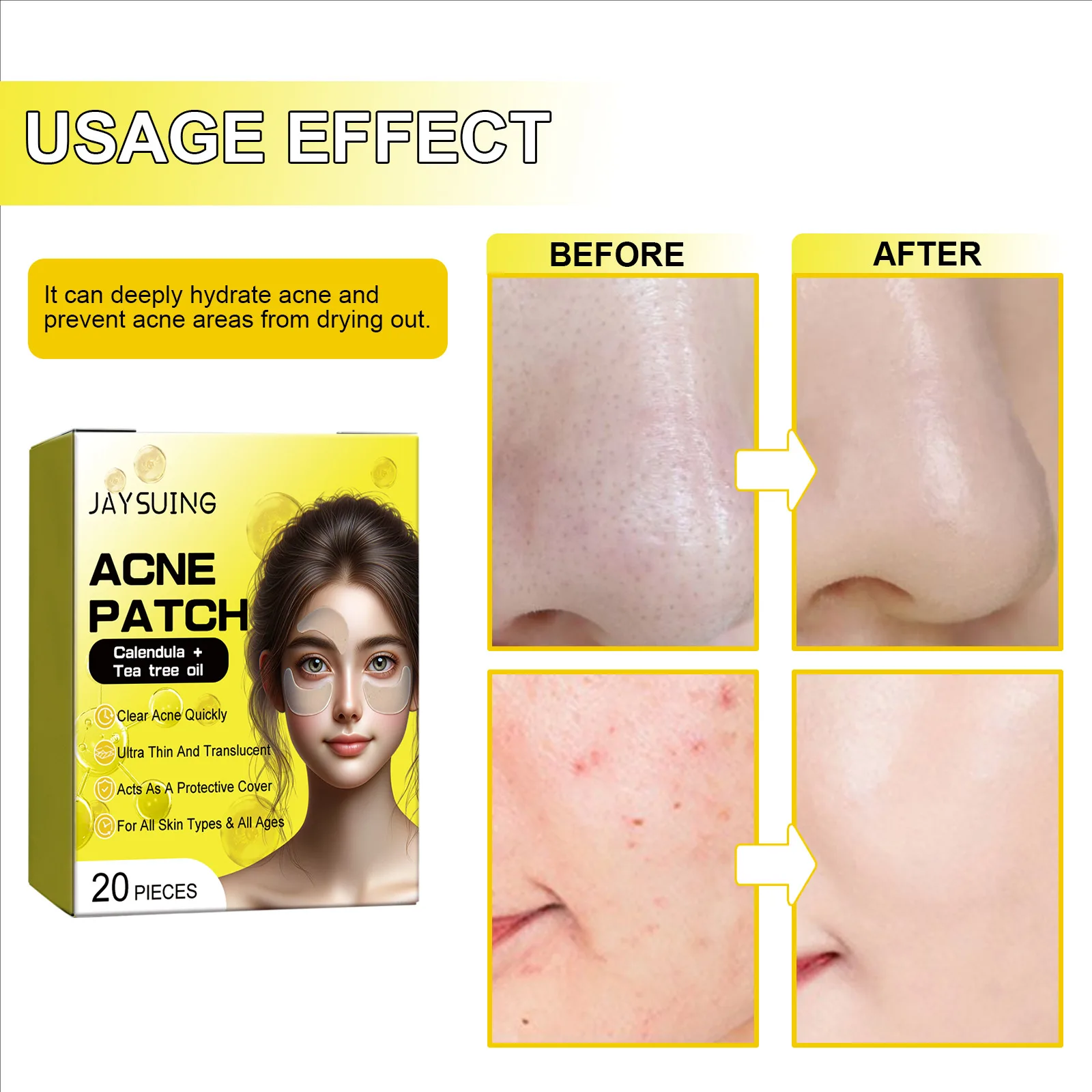 Invisible Acne Dots Pimple Absorbing Cover Patch for Face Zit Sticker Ultra Thin & Translucent Clear Quickly Repair Acne Patches