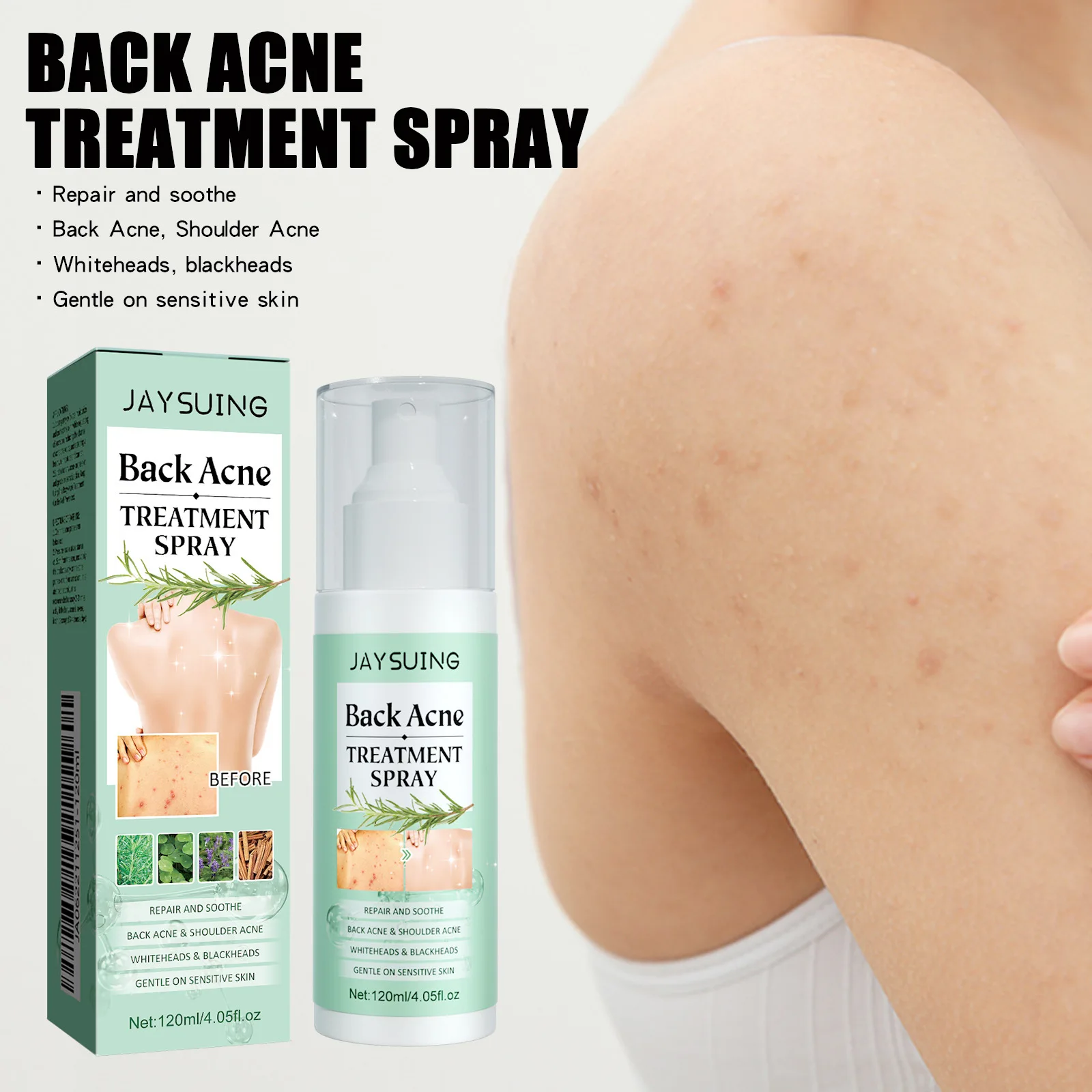 

Jaysuing Repair Back Acne Care Spray Shoulder Pimple Remove Fade Acne Scar Soothe Body Nourish Skin Cleansing Body Pimples Spray