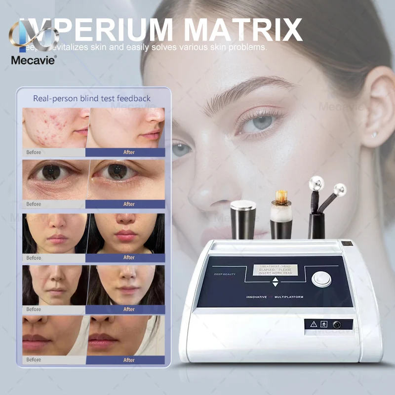 Brand‑new Mecavie Imperium Matrix RF Aesthetic Apparatus Ground‑breaking Multi‑platform Unit For Body Sculpting Wrinkle Mitigation Swan‑neck Shaping Skin Smoothing Anti‑Aging Facial And Bodily Lifting Gear Salon‑Tier Skin‑care Equipment For Professional view 4