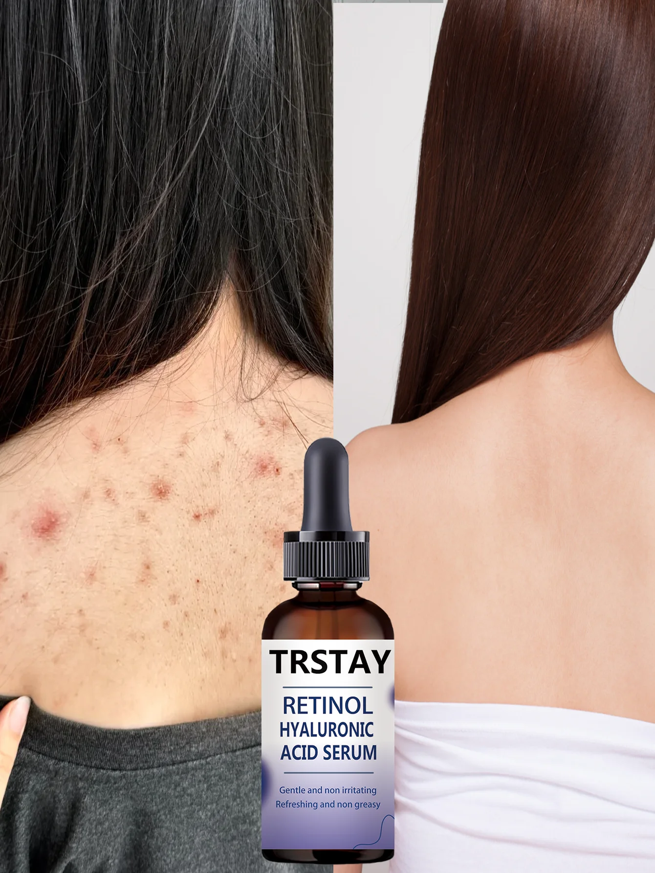 Hydrating Anti Wrinkle Double Extract Essence Fades Spots Nourishes Porcelain White Skin for Youthful Glow with Anti Aging Formu - Detail 1