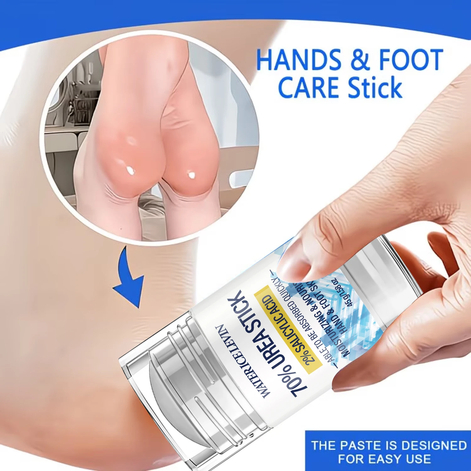 Water Ice Levin 70% Urea Stick 45g With 2% Salicylic Acid Moisturizing Nourishing Skin Care Stick For Hand And Foot Dry Skin