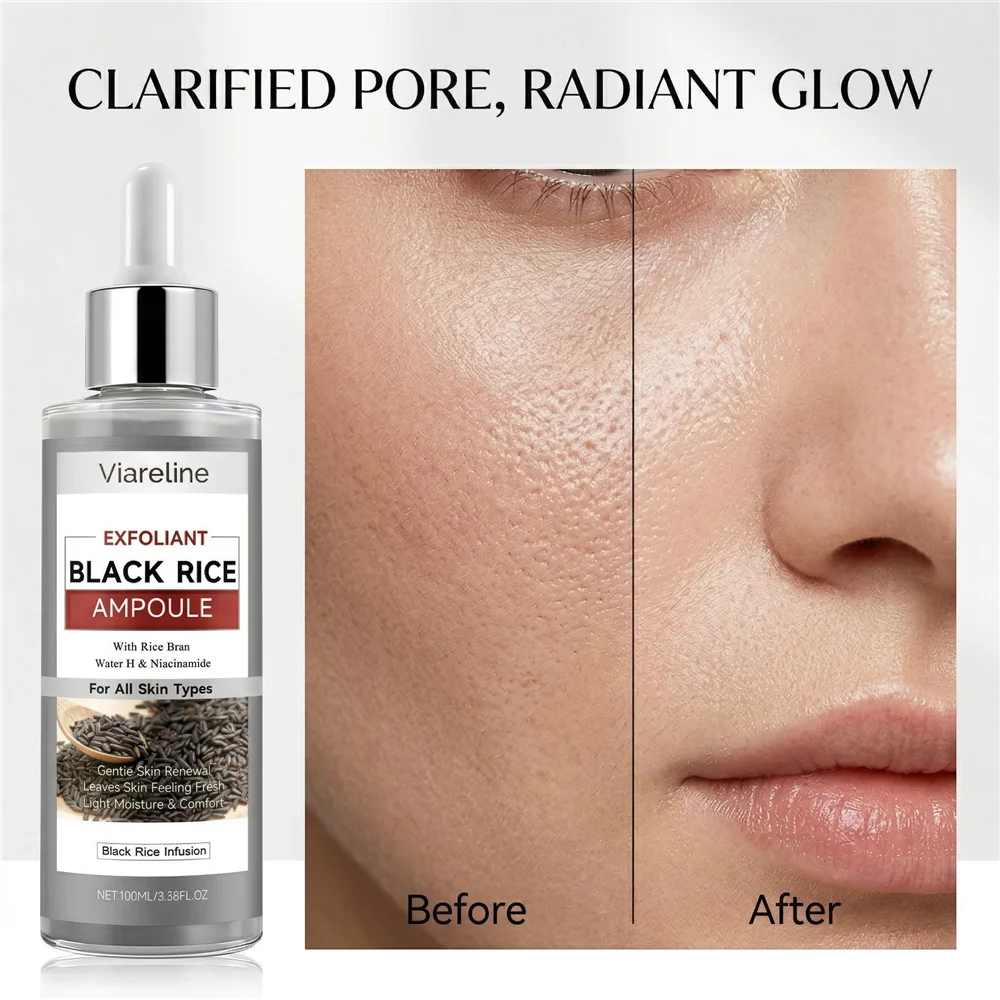 Suero Exfoliante de Arroz Negro, Solución Limpiadora Facial, Minimizador de Poros, Eliminador de Puntos Negros, Antioxidante Iluminador Facial