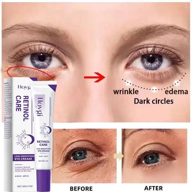 

Instant Eye Bag Removal Cream Retinol Anti-Wrinkle Firming Skin Fade Fine Lines Anti Dark Circle Puffiness Brighten Eye Care