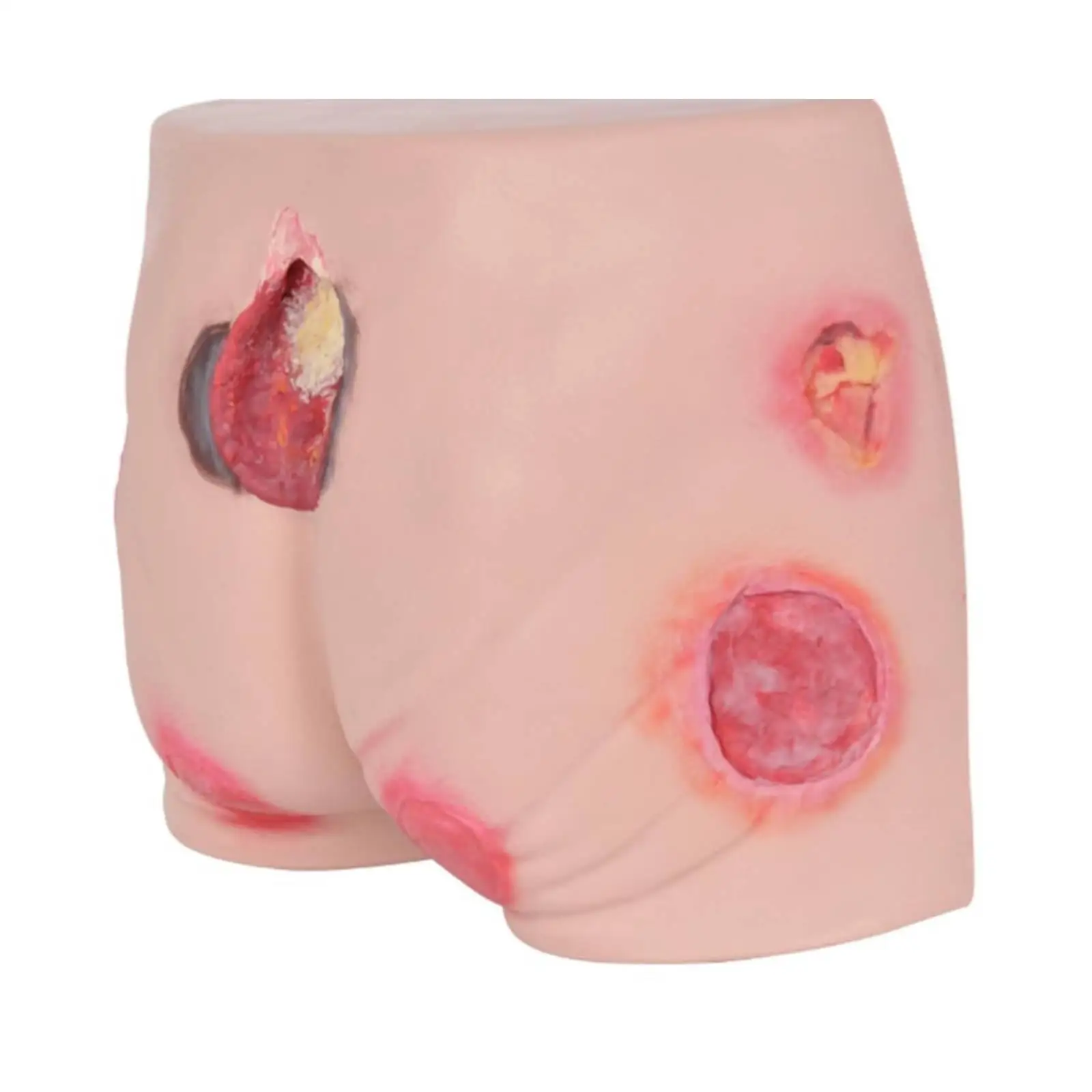 Pressure Ulcers Nursing Model Senior Pressure Ulcers Manikin Buttock Care Model Teaching Simulator Stu Education Medical Train - view 6