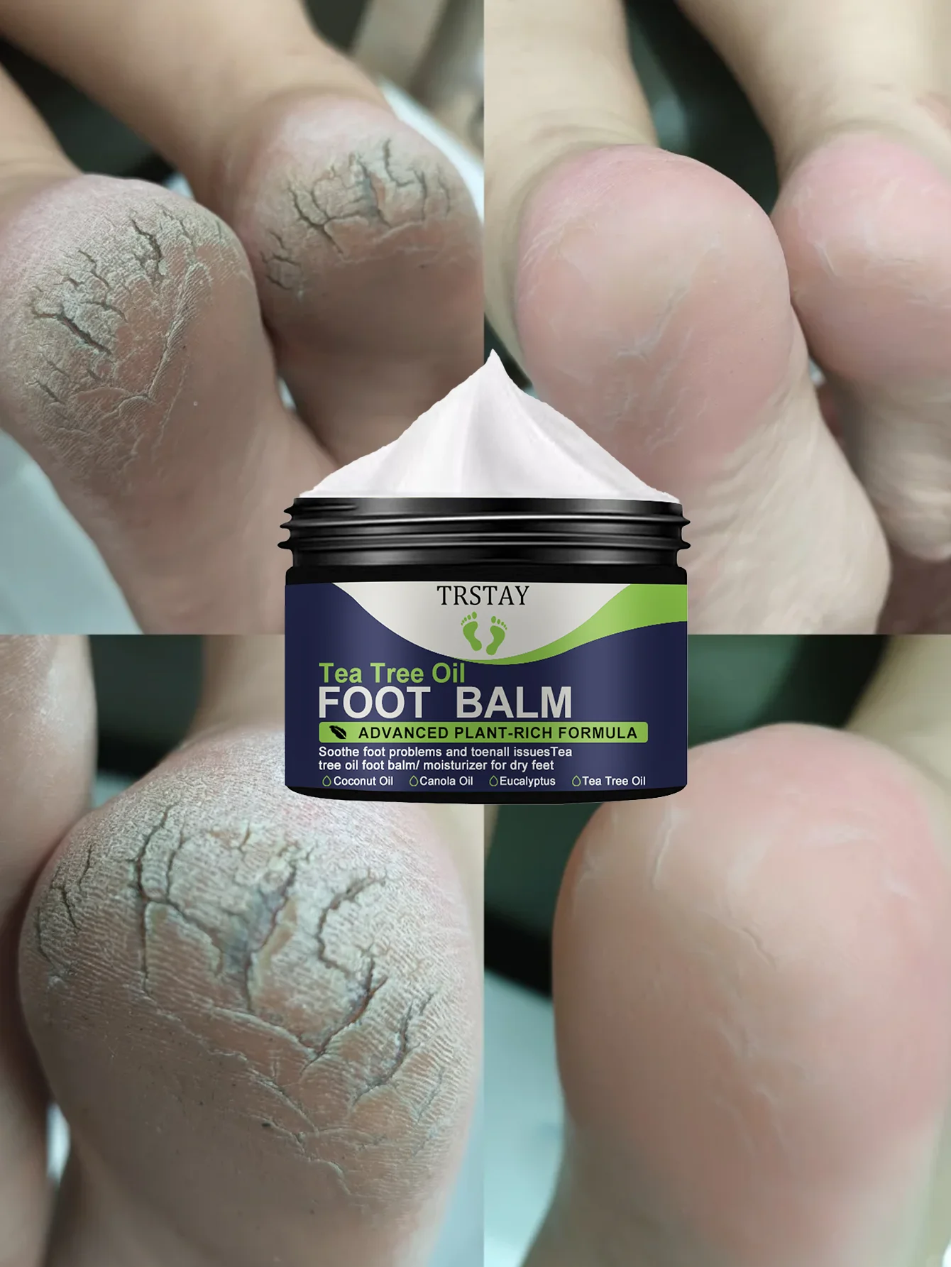 

Гладкий лосьон для ног, глубоко увлажняет, предотвращает растрескивание, уменьшает тусклость суставов, обеспечивает нежные, даже ноги, длительное увлажнение.