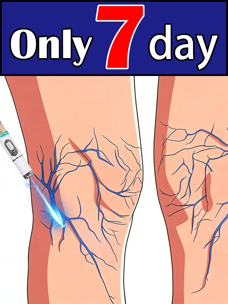 

Набор инструментов Blue Light Pen, средство для восстановления кожи ног после лазерной терапии, попрощайтесь с сосудистыми звездочками