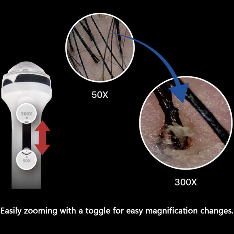 Microscope numérique Full HD, derdonoscope, détection du cuir chevelu, loupe de pores, analyseur de peau qualifiée ale, machine professionnelle