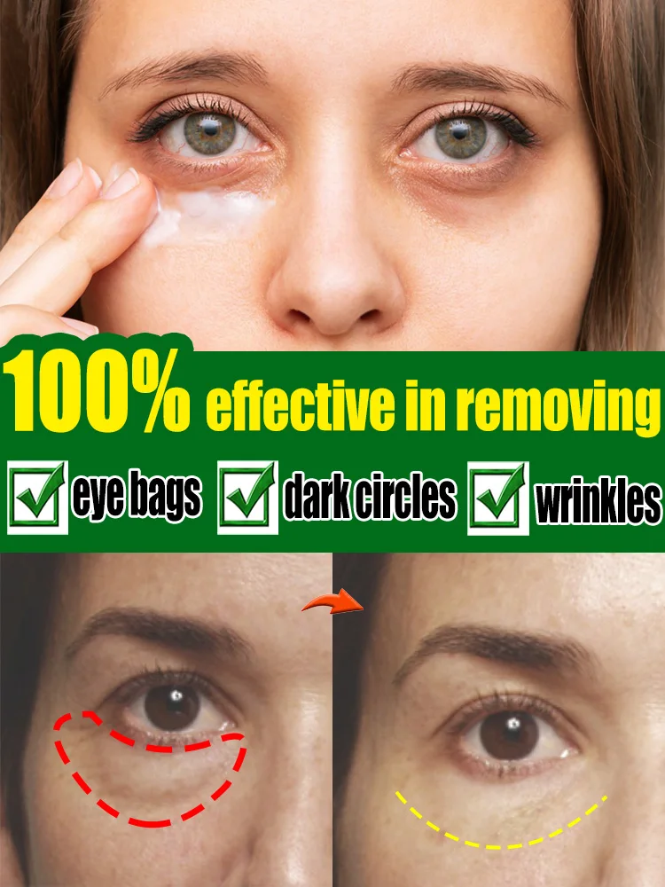 

Eye cream Under eye Bag Puffy Fat Removal