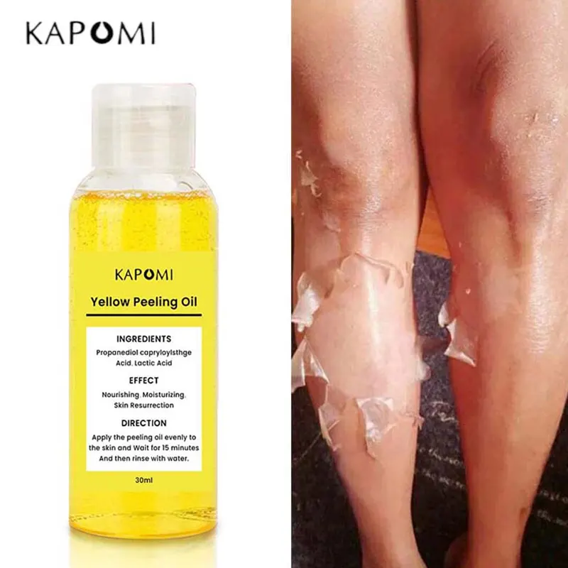 Kapomi Yellow Peeling Oil Removal Strong Dark Knuckles Remove Exfoliating Scrub Whitening Cream For Dark Skin Care Product