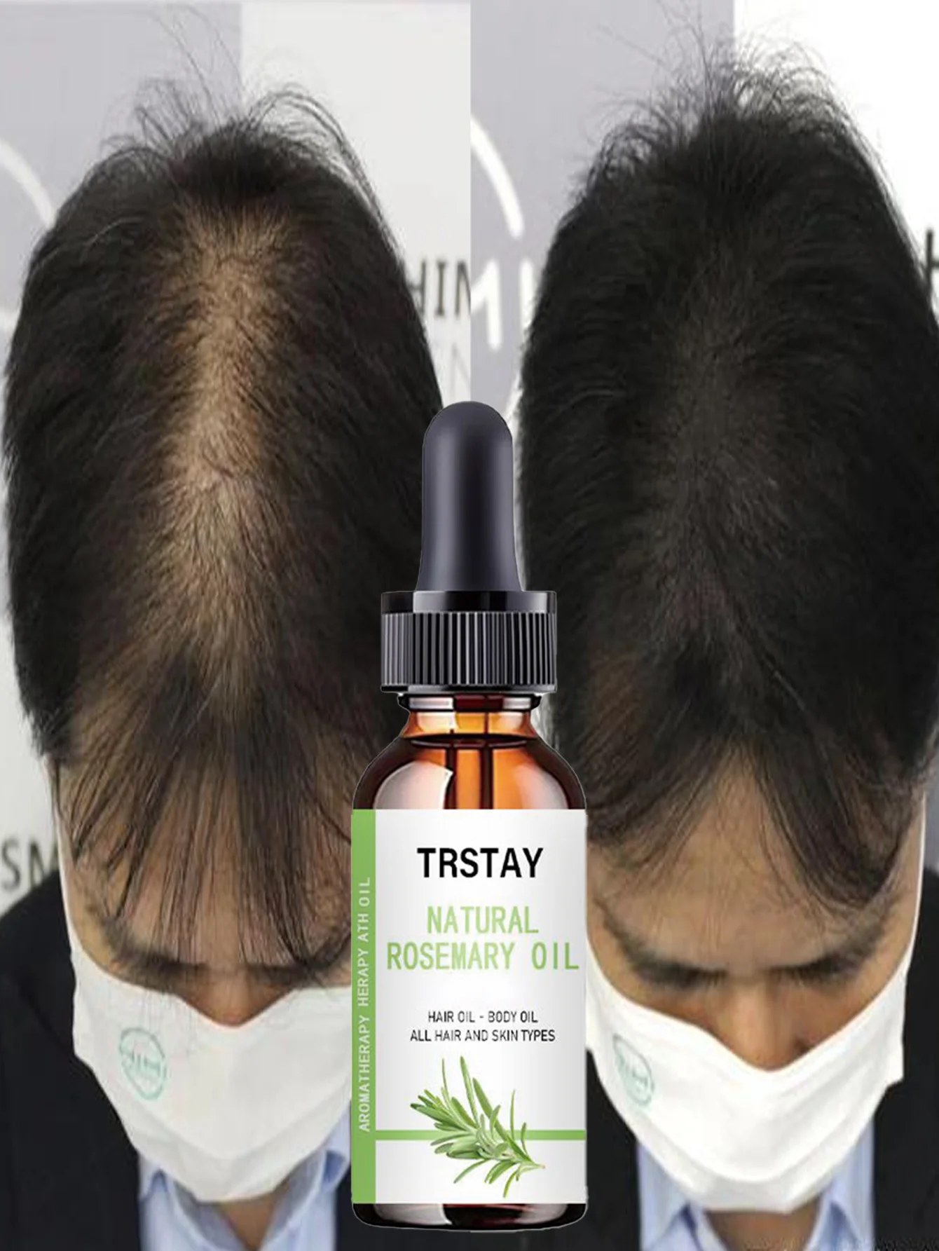 Professional Hair Treatment Oils for Nourishing Growth Tame Dry Hair Develop Smooth Style Various Specs All Hair Types Moisturiz