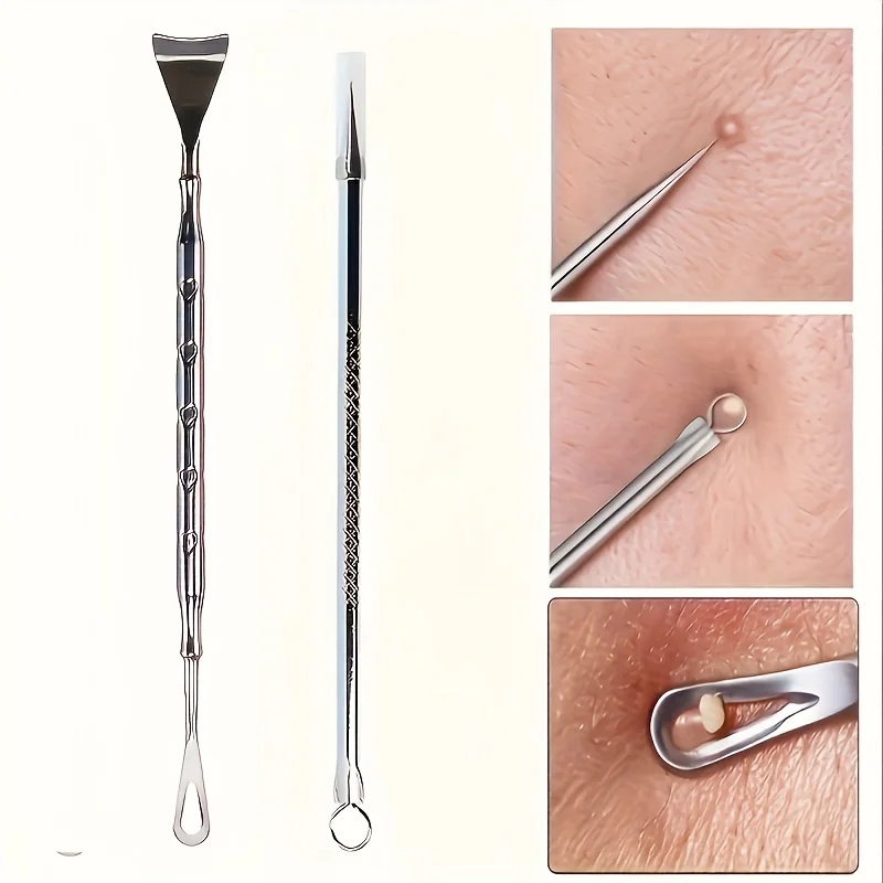 2-piece Comedone Extractor Set + Blackhead Remover Dual-Head Design, Blackhead and Pimple Picking Tool, Facial Cleansing Tool