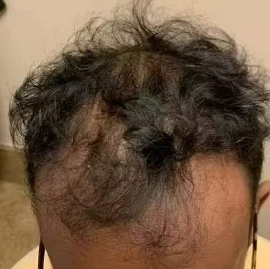Customer review photo
