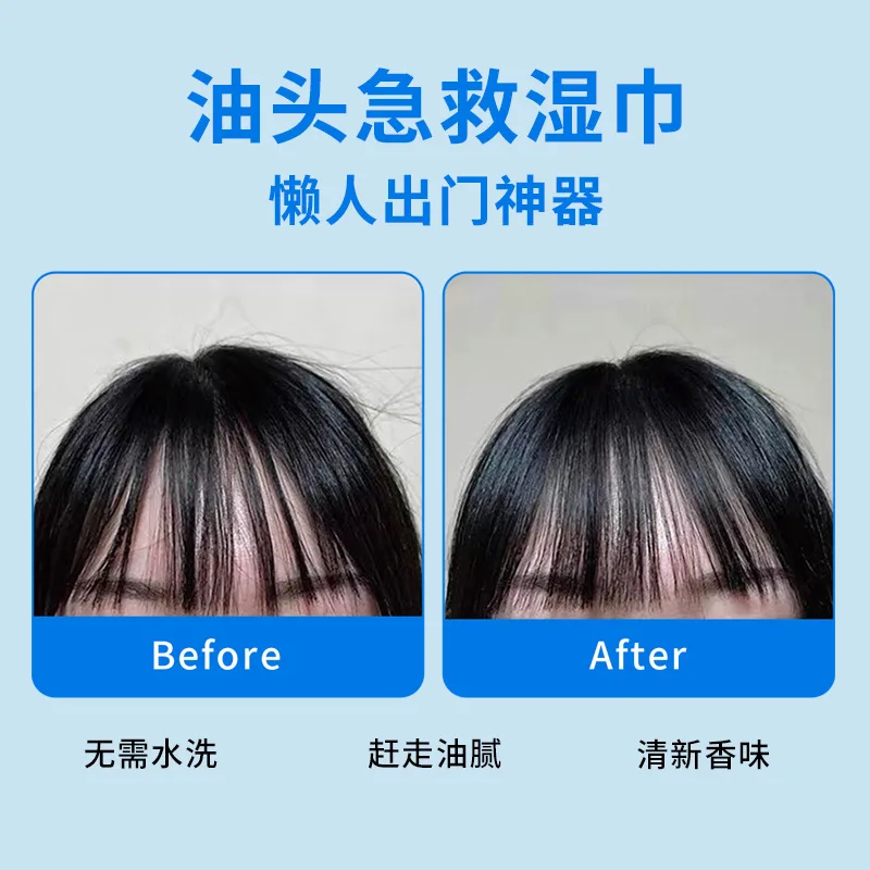 20Pcs Hair Degreasingผ้าเช็ดทําความสะอาดNo-Washแห้งทําความสะอาดเหงื่อRefreshingและFluffyผ้าเช็ดทําความสะอาดPre-Moistenedห่อ