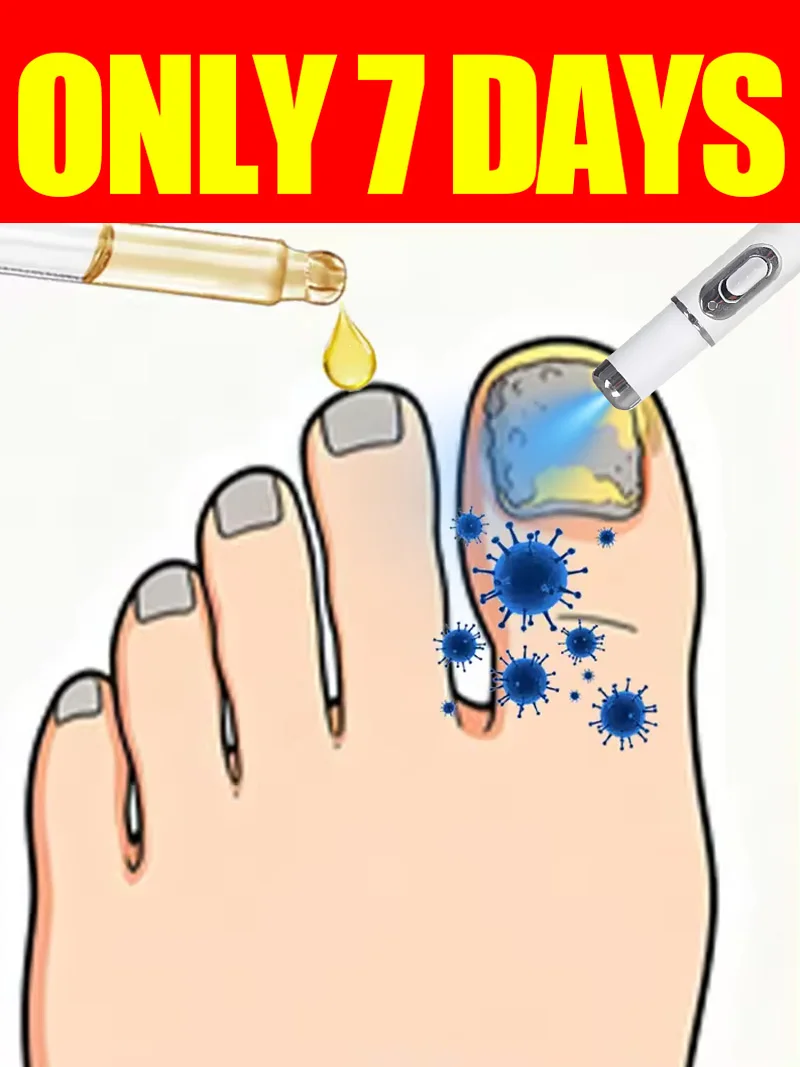 

Generation-2 Laser Says Goodbye To Bad Manicure In 7 Days