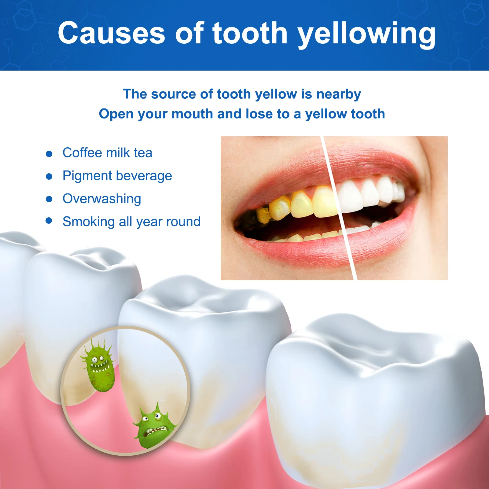 Jaysuing Teeth Cleaning Gel Remove Tea and Coffee Stains Eliminate Bad Breath Reduce Food Residue Oral Cleaning Teeth Gel