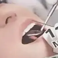 

12 шт., стоматологические зеркала для рта, отражатель из нержавеющей стали, зеркало, инструмент для гигиены полости рта, аксессуары для одонтологии, набор инструментов