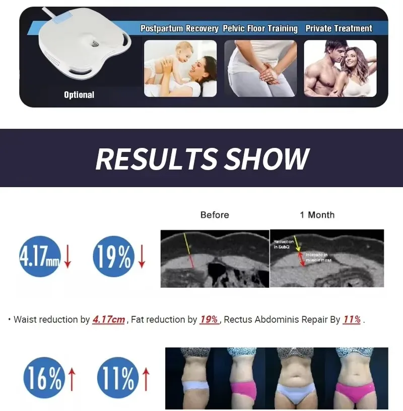 

Профессиональный аппарат Mysolim для коррекции фигуры с RF-лифтингом и электромагнитной стимуляцией мышц, оборудование для SPA-процедур и похудения