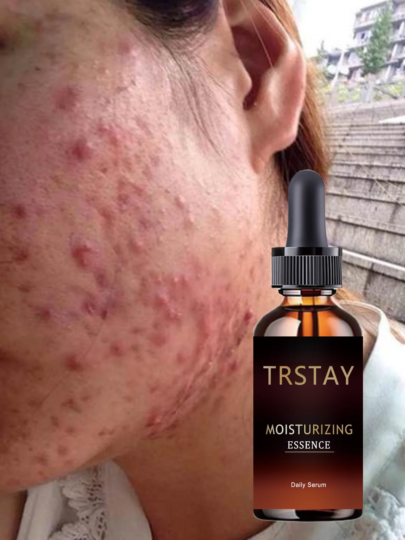 Hydrating Facial Brightening Essence Reduces Wrinkles Fine Lines Dullness Evens Skin Tone with Spot Lightening Formula for Radia - Image 6