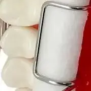 

4 шт., стоматологический держатель для рулонов из нержавеющей стали, зажим для ортодонтических лабораторных принадлежностей, хлопковый держатель, автоклавируемый