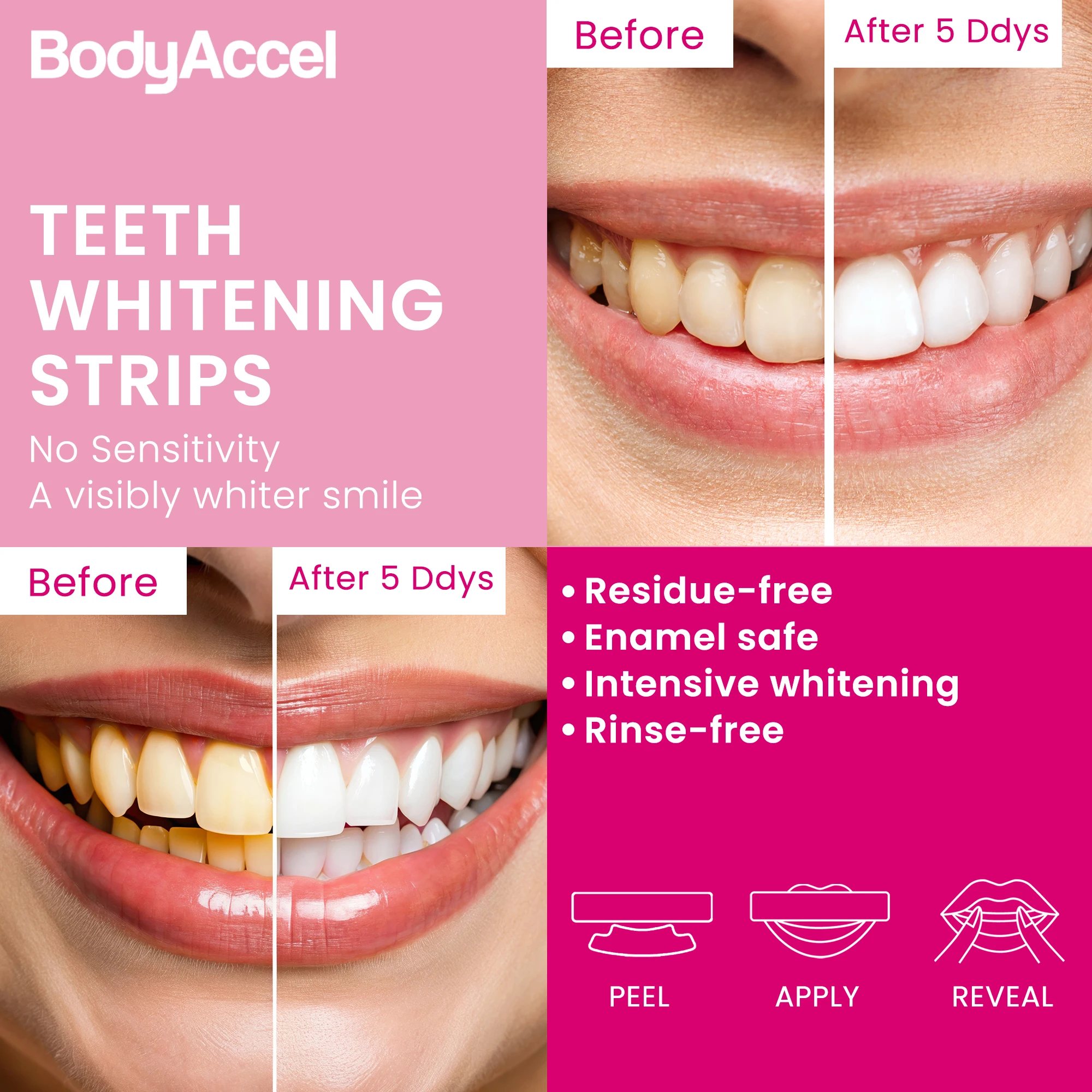 Bodyaccel Whitening Stickers Protect Teeth Clean Mouth