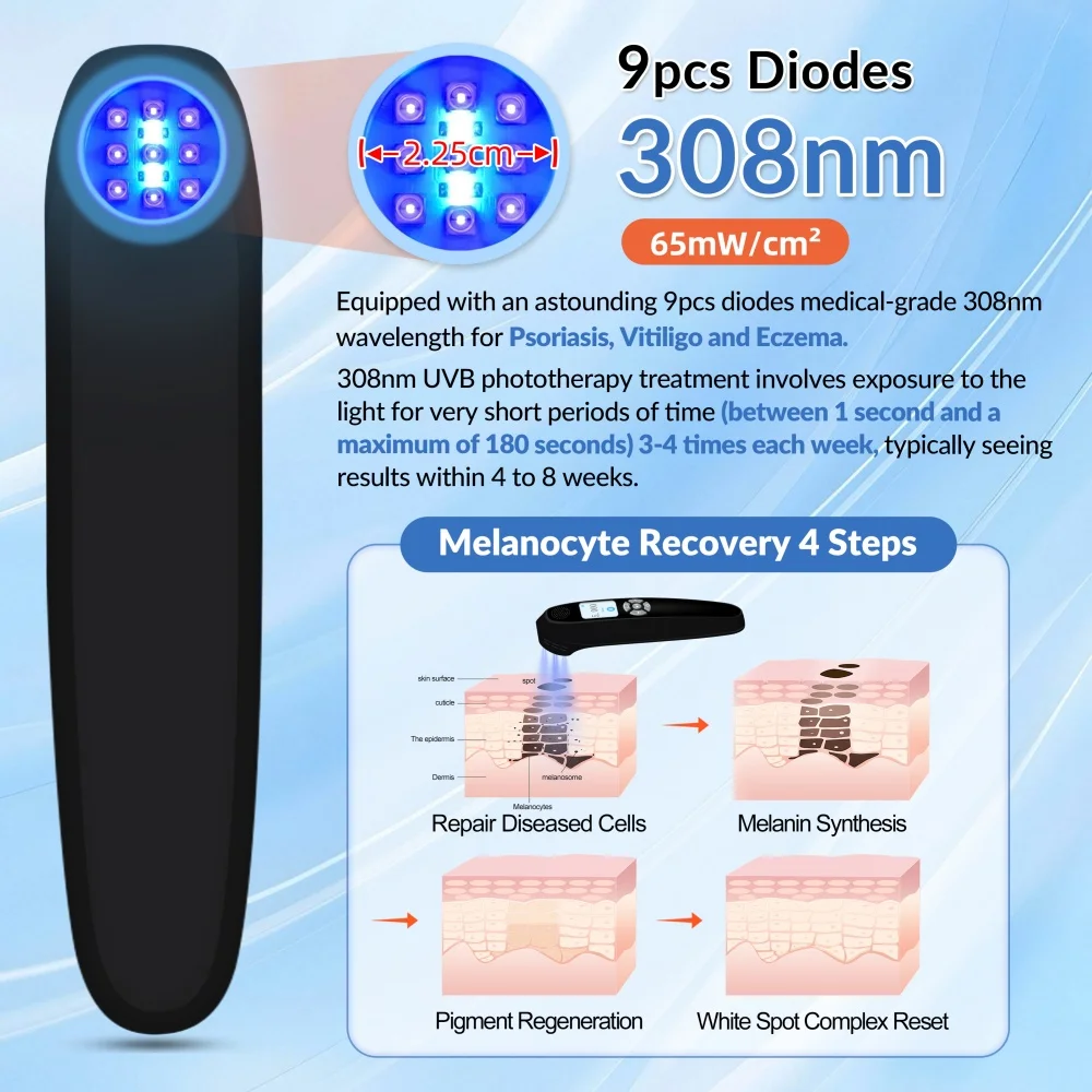 Frovab 308nm UVB Excimer Laser Phototherapy Lamp Medical Grade Skin Disorder Treatment Vitiligo Psoriasis Eczema Device