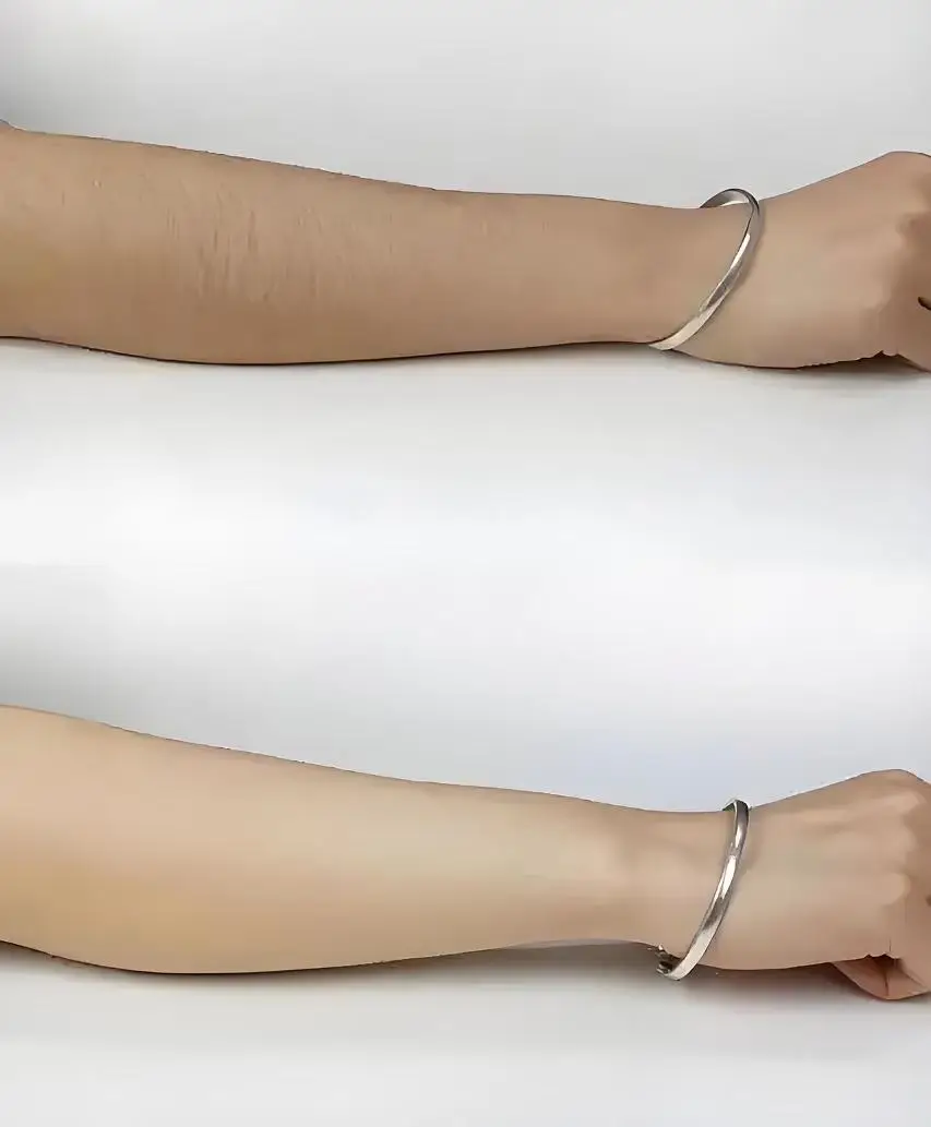 

808nm Platinum Ice Laser Diode Hair Removal Machine, Best Painless Skin Care Device, 3 Wavelengths: 808, 1064, 755nm