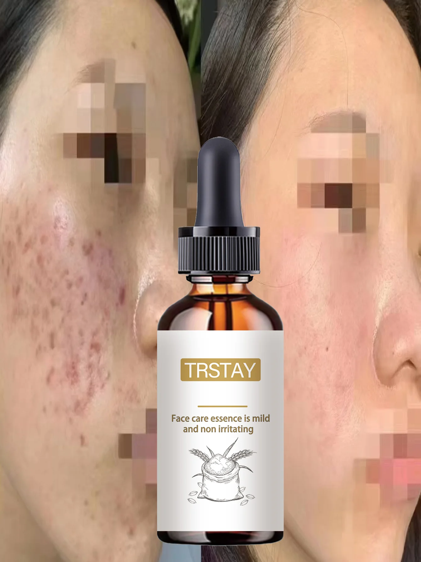 Moisturizing Spot Lightening And Skin Brightening Essence With Hydrating Formula To Even Skin Tone And Enhance Glow For Radiant