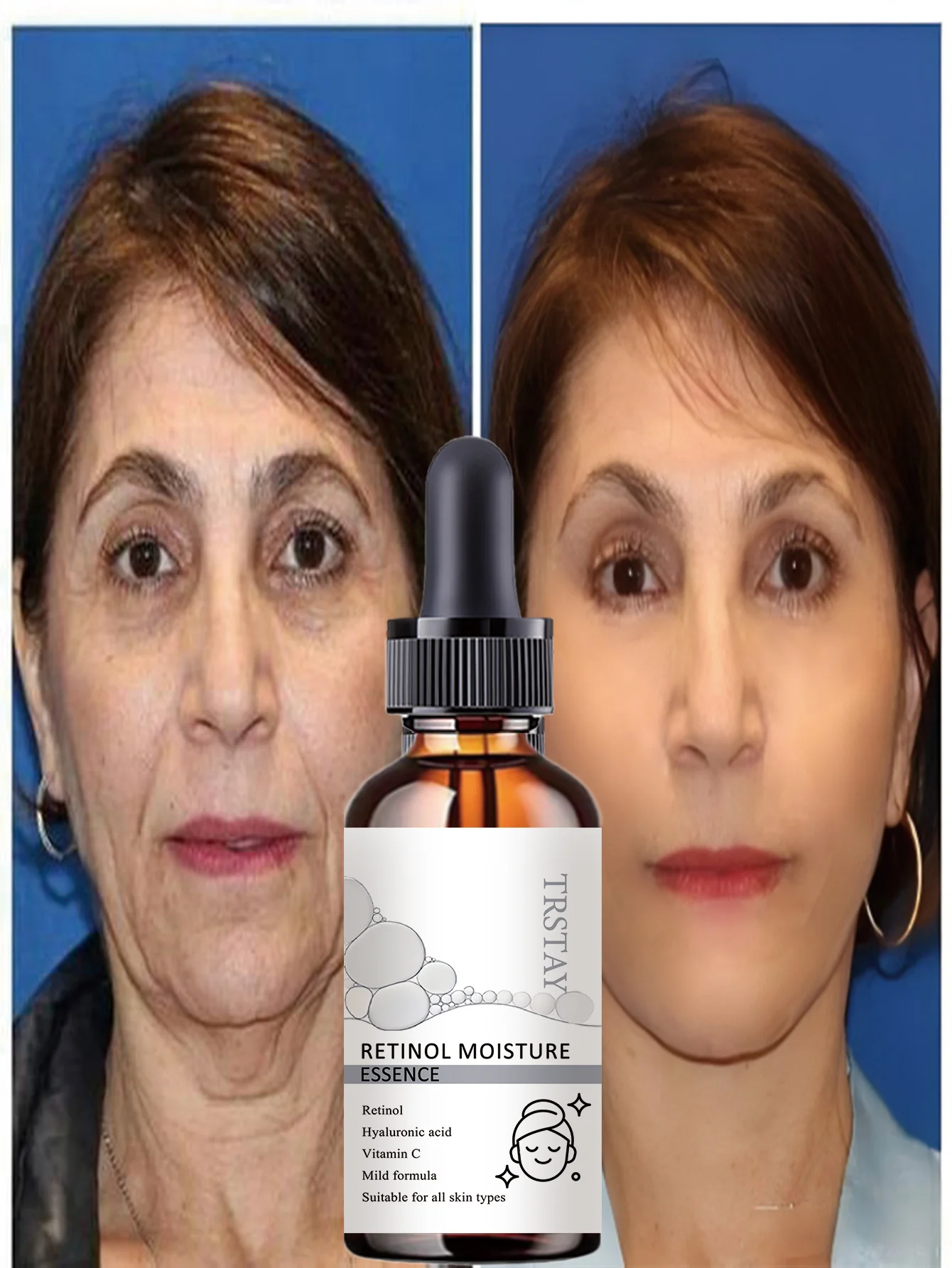 All-season Hydration Oil Year-round Solution Deep Moisturizing Facial Treatment for Dry Skin Nourishing and Revitalizing Serum w - Image 4