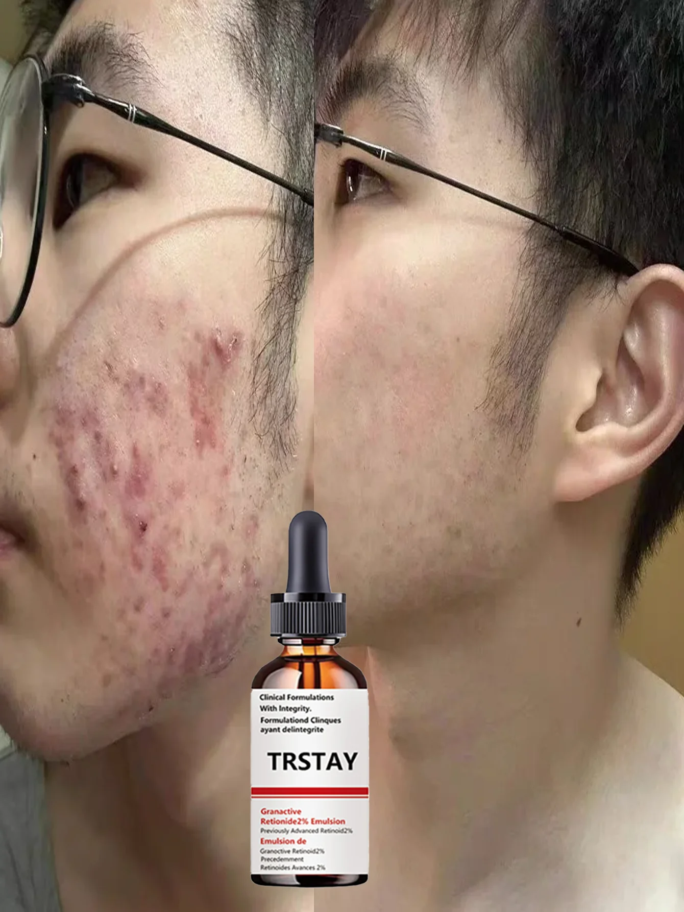 Hydrating Anti Aging Serum Brighten Complexion Reduce Wrinkles Smooth Texture Even Tone Revitalize Glow Multi Effect Repair Esse - Image 4