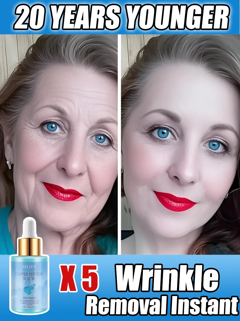 Less wrinkled wrinkle lifting